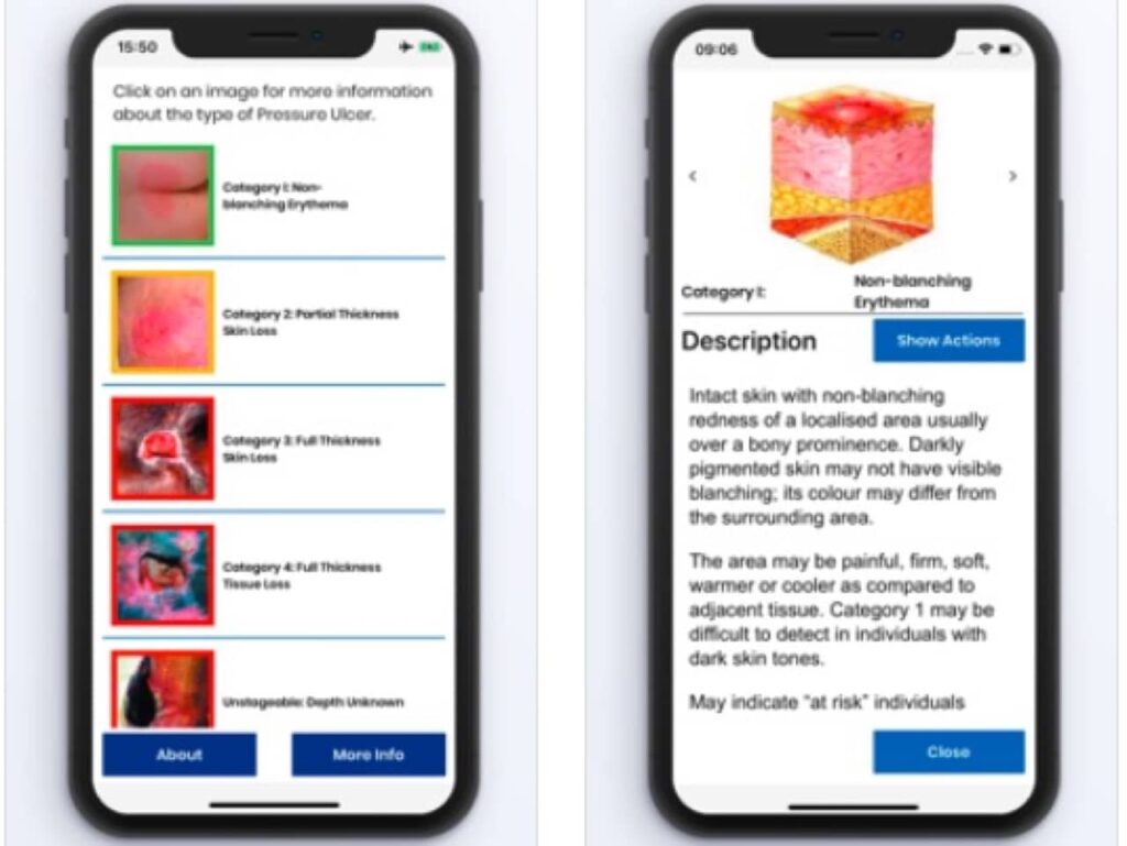 Pressure Ulcer App Launched for Carers Nationwide