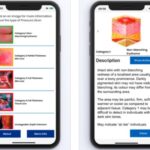 Pressure Ulcer App Launched for Carers Nationwide