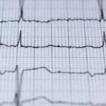 ECG Monitoring for Mental Health Service Users